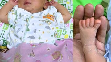 Hal Normal yang Terjadi pada Bayi Baru Lahir