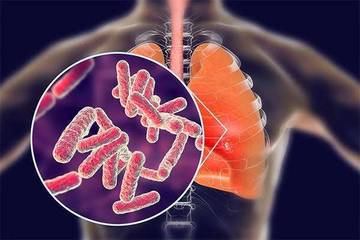 Merokok Rentan Menderita Tuberkulosis