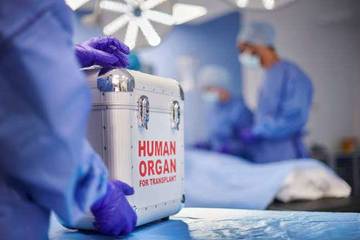 Operasi Transplantasi Tersulit yang Pernah Dilakukan