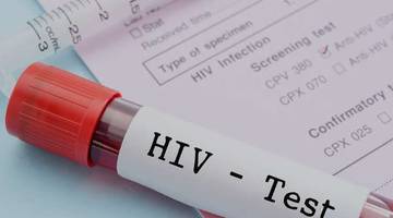 Dinas Kesehatan Way Kanan Intensif Edukasi HIV