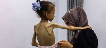 Gaza: Antara Kelaparan dan Ujian Kemanusiaan Dunia